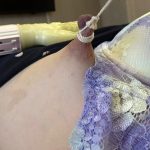 Thumbnail of related posts 175